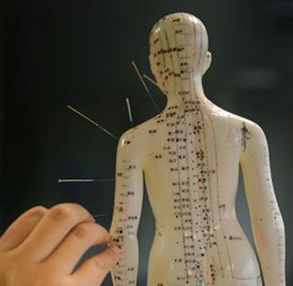 Acupuncture Support